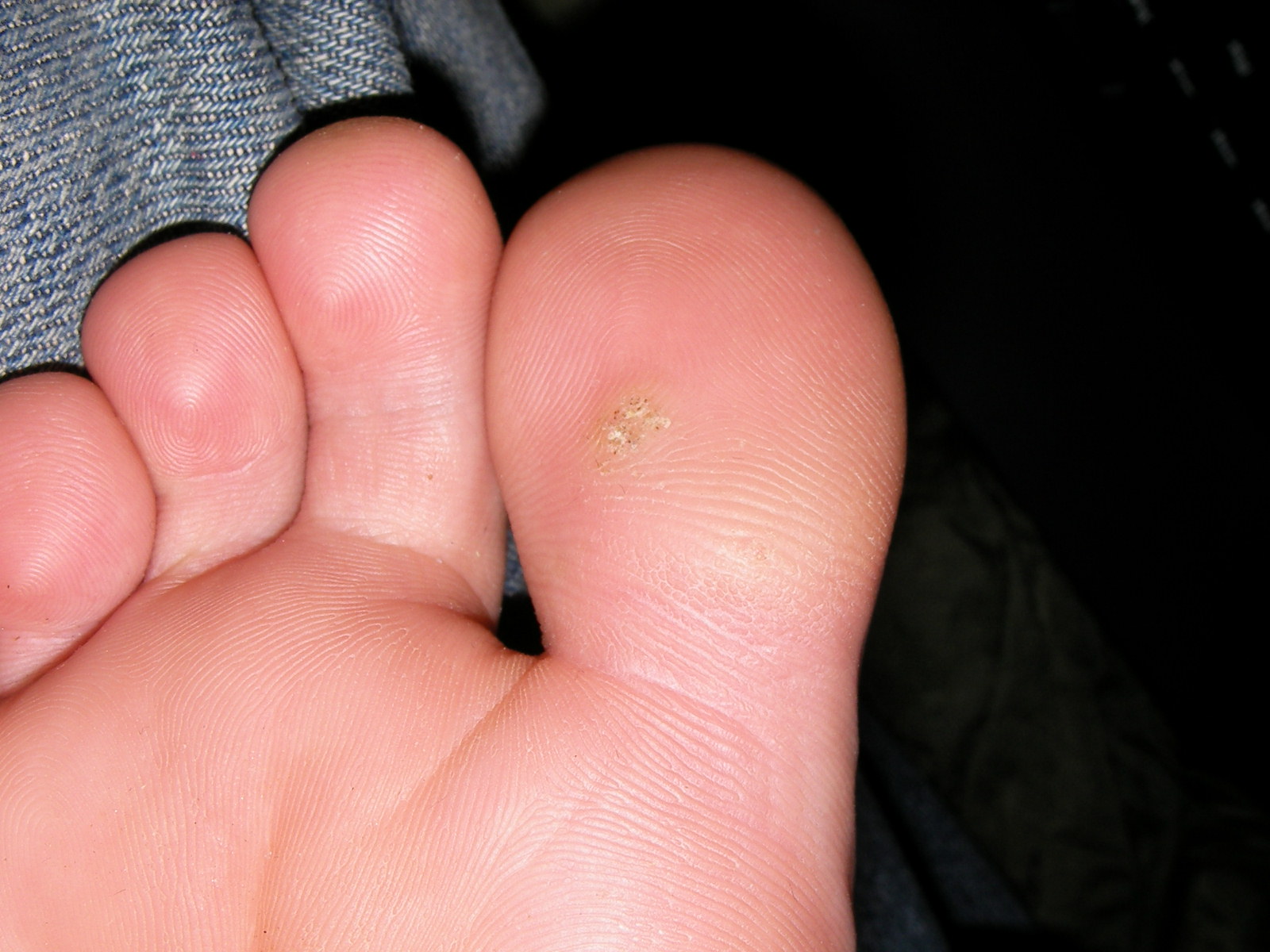 toes