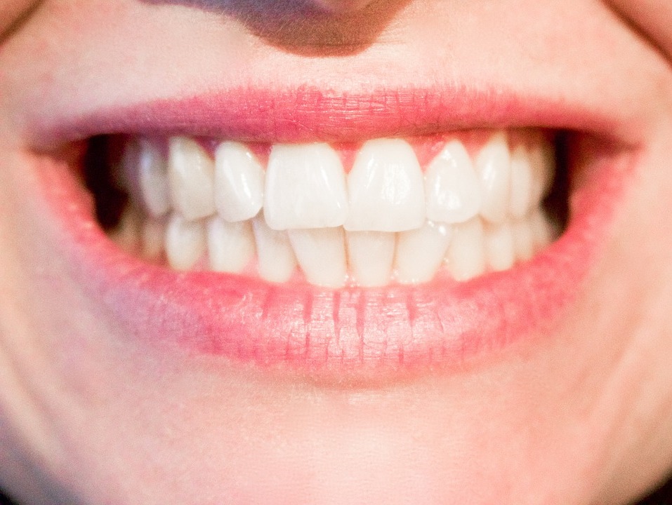 white teeth